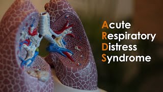 Acute Respiratory Distress Syndrome ARDS for USMLE Step1 and USMLE Step 2 [upl. by Nimajaneb180]