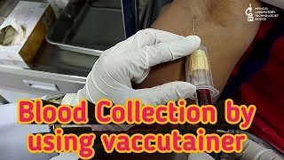 Blood collection by using vaccutainer methodclosed system of blood collection [upl. by Carce]