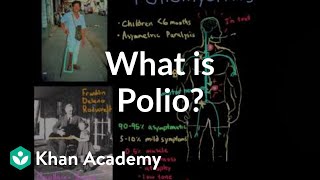 What is polio  Infectious diseases  NCLEXRN  Khan Academy [upl. by Adelice]