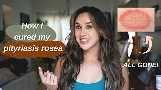 How I Cured My Pityriasis Rosea [upl. by Rotciv]