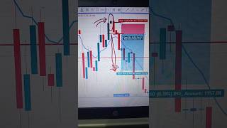 Doji Candle Big PROFIT Strategy💲🤑  Options Trading strategies for beginners trading nifty shorts [upl. by Elmaleh]