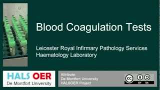 Automated Blood Analyser Part 6 CoagulationTest [upl. by Hsilgne521]