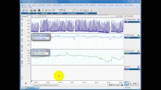 Calculating systolic diastolic and MAP from blood pressure traces [upl. by Tremayne]