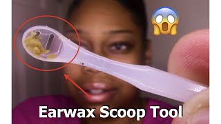 ASMR Scooping HARD Earwax Satisfying [upl. by Siobhan36]