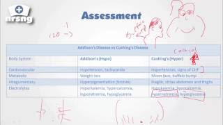 Cushings Syndrome NCLEX® Review  NRSNGacademycom [upl. by Sussi]