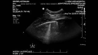 Échographie d’un poulain présentant des fractures de côtes adjacentes au cœur [upl. by Sirob]