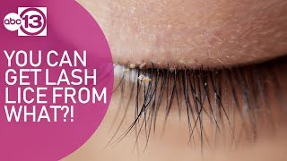 Risk of lash lice from this beauty product [upl. by Neirb]