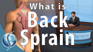 What is a Back Sprain [upl. by Leighland]