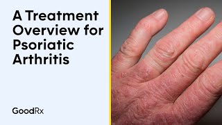 A Treatment Overview for Psoriatic Arthritis  GoodRx [upl. by Mccurdy]