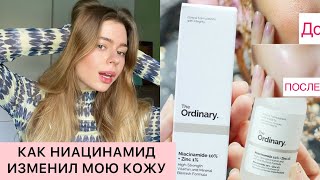 Doctor DESTROYS The Ordinary Niacinamide 10 [upl. by Romain460]