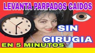 COMO LEVANTAR LOS PARPADOS CAIDOS EN 5 MINUTOS SIN CIRUGIA [upl. by Arramat]