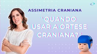 Dra Clarice  Responde quotQuando é indicada a órtese cranianaquot  O famoso quotcapacetinhoquot [upl. by Margy]