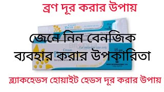 benzac cream এর উপকারিতা। ব্রণ দূর করার ক্রিম।Cream Benzac uses  Whiteheads removal cream [upl. by Goddord552]