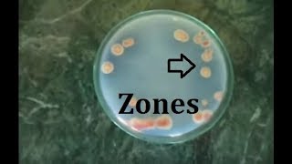 How to isolate phosphate solubilizing bacteria [upl. by Iel]