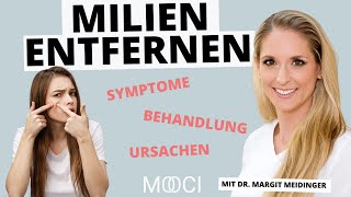 Milien  Wie kann man sie entfernen [upl. by Yllitnahc]