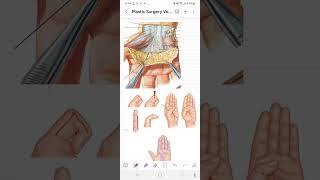 Hand palmar vs dorsal skin [upl. by Ovatsug]