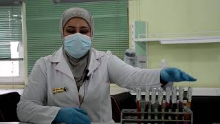 Biochemical Tests  Assist Inst Sanaa Basheer Kadhem [upl. by Darra257]