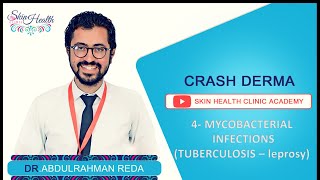 4  MYCOBACTERIAL INFECTIONS شرح الجلدية الجزام والدرن دعبدالرحمن رضا [upl. by Michelsen]