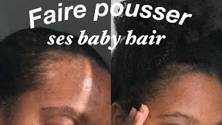 6 ASTUCES POUR FAIRE POUSSER SES BABY HAIR RAPIDEMENT tempes dégarnies alopécie [upl. by Caravette]