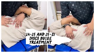 🚀L4L5 and L5S1 Discs Bulge Treatment 🔥Best Chiropractic Adjustment in KolkataDr PS Neogi [upl. by Kiah270]