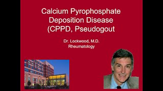 10 Calcium Pyrophosphate Deposition Disease Pseudogout [upl. by Pilar338]