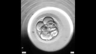 FIV  Vue au microscope du développement embryonnaire [upl. by Desma]