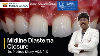 Live Demonstration on Midline Diastema Closure BY DRPRADEEP SHETTY MDSPhD [upl. by Yrogerg]