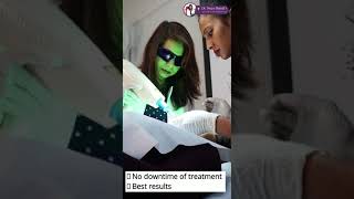 Freckles Treatment by Dermatologist  How to Get Rid of Freckles  Dr Naiya Bansal [upl. by Airom]