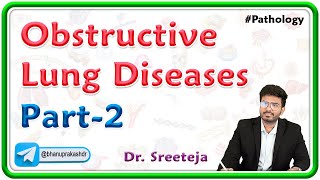 2 Obstructive Lung Diseases Part 2  USMLE Step 1 Pathology [upl. by Assele453]