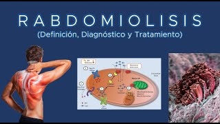 Rabdomiolisis Definición Diagnóstico y Tratamiento [upl. by Gigi]