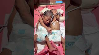 Two Premature Baby Journey medical newbornbaby viralvideo [upl. by Dumm]