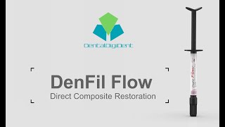 DenFil Flow Class I Resin Restoration en DentalDigiDent España [upl. by Narret]