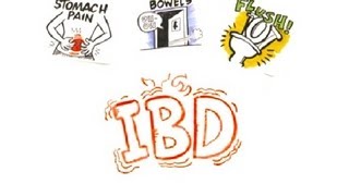 Inflammatory Bowel Disease IBD [upl. by Anail]