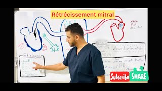 Rétrécissement mitral [upl. by Ahsinrats]