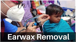 Earwax Removal from children  How to remove hard wax from small children  Video otoscaopy [upl. by Bobker]