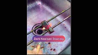 Ziehl Neelsen stainingZN stainingAFB staining Afb tb znstain [upl. by Eeldarb371]