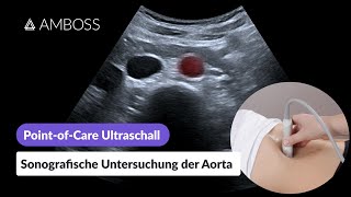 PointofCareUltraschall Teil 14 Sonografische Untersuchung der Aorta  AMBOSS [upl. by Jelene]