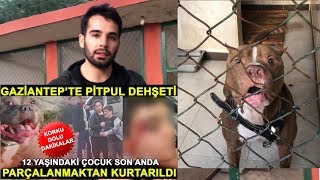 ÇOCUĞUN ELİNİ PARÇALAYAN PİTBULL’un YANINA GİTTİM [upl. by Aisayt]