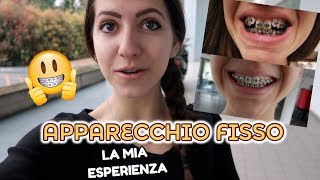 APPARECCHIO FISSO  Aggiornamento dopo un anno [upl. by Anya908]