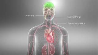 Barostim™ Baroreflex Activation Therapy Animation [upl. by Gent]