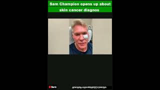 Sam Champion opens up about skin cancer diagnosis surgeryShorts [upl. by Anitroc]