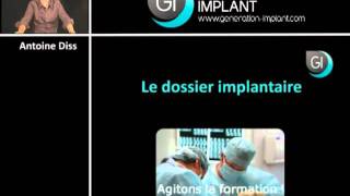 Implant dentaire  Le dossier implantaire [upl. by Hgielram]