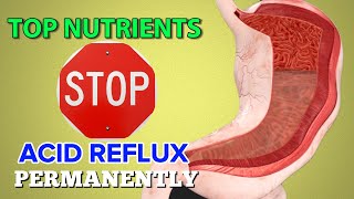 5 Vitamins  Minerals to Stop Acid Reflux Permanently [upl. by Debarath]