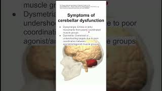 Symptoms of cerebellar dysfunction [upl. by Daniell387]