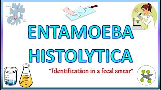 Entamoeba Histolytica  Morphology of the Trophozoite amp Cyst on Light Microscope Stools for AOC [upl. by Newg622]