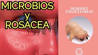 La MICROBIOTA y enfermedades de la piel como la ROSACEA [upl. by Analim]