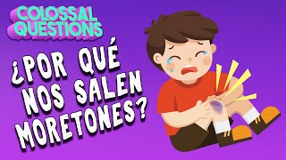 ¿Por qué nos salen moretones  PREGUNTAS COLOSALES [upl. by Imuya]