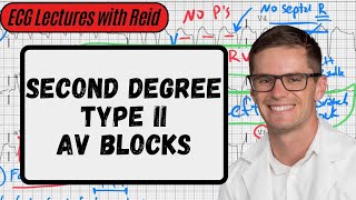 2nd Degree Type II AV Blocks  Day 6 ECG Challenge [upl. by Lunseth]