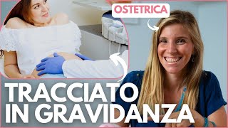 TRACCIATO IN GRAVIDANZA Cosè come funziona a cosa serve e quando si esegue la cardiotocografia [upl. by Story]