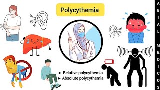 Polycythemia  Relative polycythemia  Absolute polycythemia  Polycythemia Vera [upl. by Benia745]